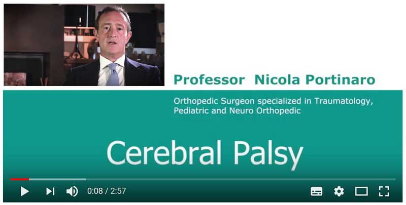 What is Cerebral Plasy Video by Prof. Portinaro
