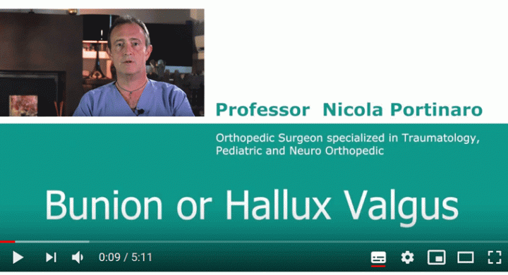 Nicola Portinaro Orthopedic Surgeon Video Bunions
