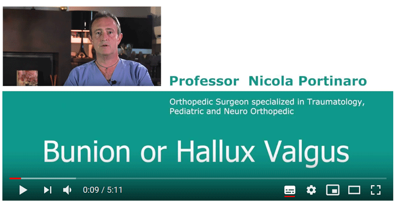 Nicola Portinaro Orthopedic Surgeon Video Bunions