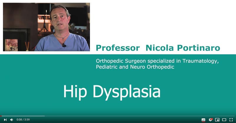 hip dysplasia baby portinaro